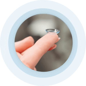 لنزهای سختی که شب‌ها استفاده می‌شوند و شکل قرنیه را موقتاً تغییر می‌دهند. مزایا: دید واضح در روز بدون عینک کنترل مؤثر مایوپیا معایب: هزینه بالاتر نیاز به پیگیری دقیق اثربخشی: تا ۶۰٪ کاهش رشد طول چشم